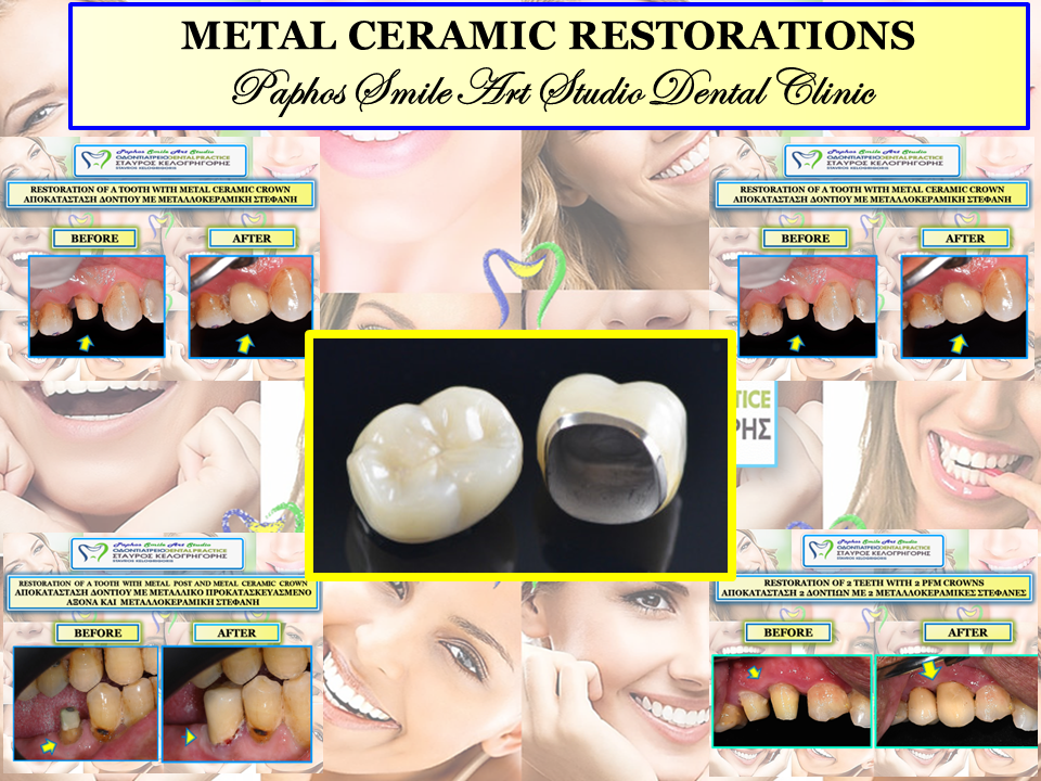 The No. 1 star smile makeover Mistake You're Making and 5 Ways To Fix It