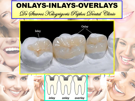 Dr Stavros Kelogrigoris Paphos Dental Clinic